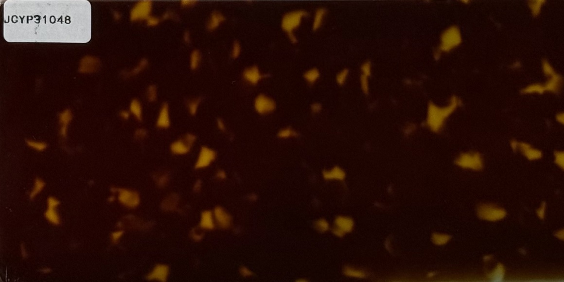 JCYP31048